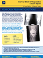 How will you ensure my knee is balanced and confortable? – Dr. Roger Brighton - Hip & Knee Surgeon